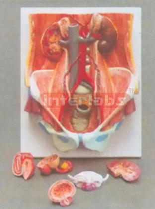 DELUXE HUMAN URINARY SYSTEM MODEL OF THE MALE AND FEMALE RECHANGEABLE